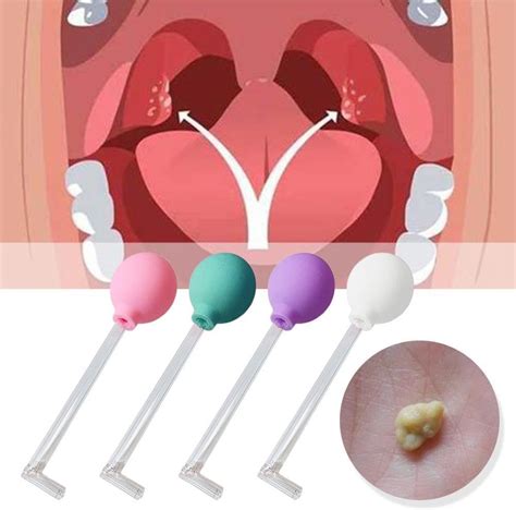 vacuum for tonsil stones|mouth vacuum for tonsil stones.